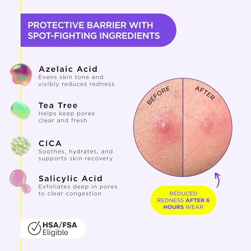 ZitSticka Liquid Pimple Patch - Invisible Pimple Patches for Face, Pimple Cream, Salicylic Acid Spot Cover For Face, Liquid Pimple Patch Large & Clear Fits to Makeup (0.3oz,10ml)