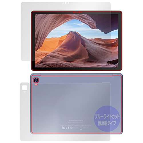 ~rbNX VANKYO MatrixPad S31X p u[CgJbg ᔽ ڂɗD ی tB tEw Zbg { OverLay Plus Eye Protector