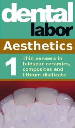 Thin veneers in feldspar ceramics, composites and lithium dislicate (dental lab techonology articles Book 3)