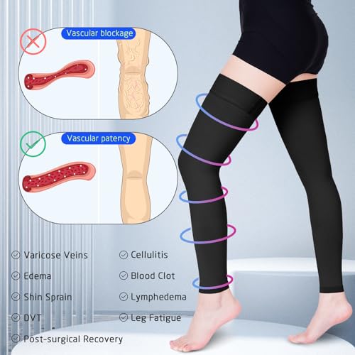 Image of 15-20 mmHg Compression Stockings for Women & Men, Thigh High Compression Socks Medical Graduated Compression Support for Edema, Varicose Veins