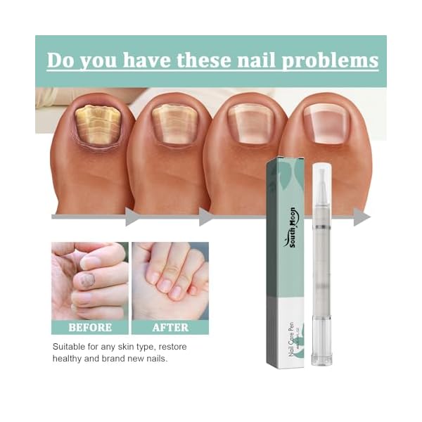 4 StüCk Health Nail Care Pen Routine Nagelpilz Stift, Poderm Nagelpilz Nagelpflegestift, Nail Care Pen Health Nail Nagelwachstum FöRdern – Bild 8