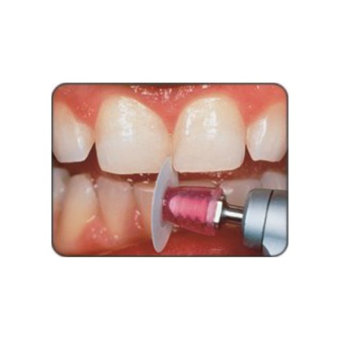 3m Espe 1981c - Sof-lex Contouring And Polishing Discs Refill 3/8 Diam