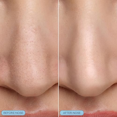 Image of Biore Pore Refining Bubbling Nose Mask, Glycolic Acid Exfoliant, 8 ct | Pore Cleansing Mask, Blackhead Remover, Glycolic + Hyaluronic Acid, Exfoliating Face Mask, Minimizes Pores