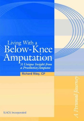 Buy Living with a Below-knee Amputation: A Unique Insight from a Prosthetist / Amputee — BookShops.in