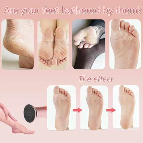 Generic RAVIFUN-FOOTFILE Electric Foot Callus Remover,Electric Callus Remover For Feet,With 60Pcs Sanding Disc,Electric Speed Adjustable Foot File thumb #3