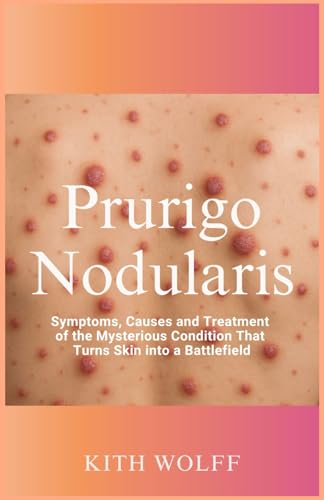 Prurigo Nodularis: Symptoms, Causes, and Treatment of the Mysterious Condition That Turns Skin into a Battlefield