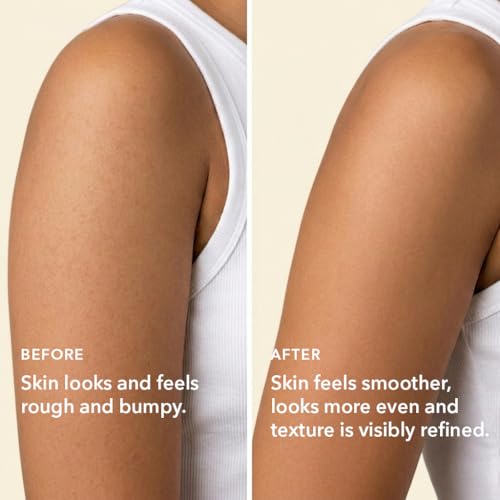 Image of Boofootel SOOPERSMOOTH Body Serum for Bumpy Skin, Dark Spots & Pigmentation | Glycolic Acid, Lactic Acid, Vitamin C, Niacinamide | Body Brightening & Dark Spot Serum | Smooth, Even Skin Tone & Ingrown Hair Treatment | 100g