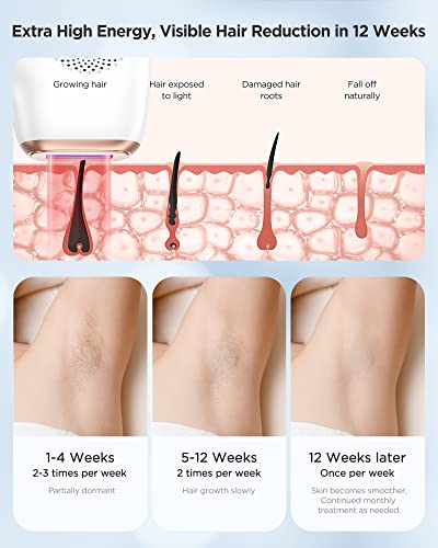 INNZA Laser Hair Removal for Women Permanent, 999,999 Flashes Painless IPL Hair Remover with Ice Cooling Care Function, Hair Removal Device for Armpits Legs Arms Bikini Line (White)