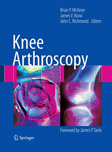 Knee Arthroscopy view 2