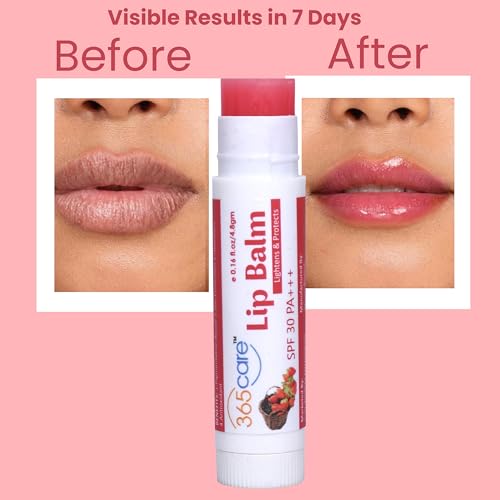 Image of Strawberry Lip Balm for Dark Lips Lightening with SPF 30 PA+++ | Sun Protection & Moisturizing | Lip Balm with Kojic Acid, Vitamin E & Shea Butter | For Men & Women | 4.8g (Pack Of 2)