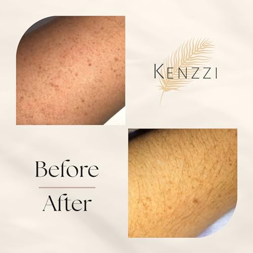 KENZZI IPL PRO Hair Removal Device の商品画像 6