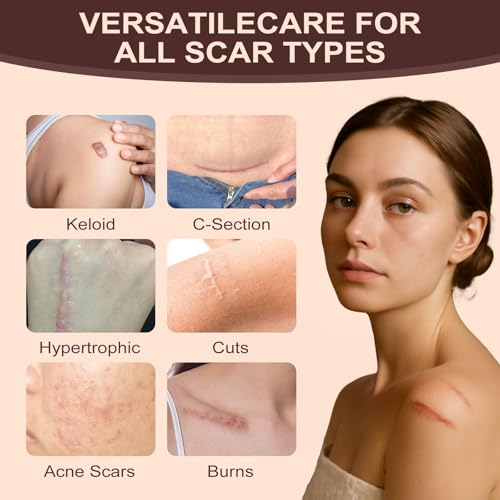 scar solutions silicone scar stick60 silicone for face and body stick applicator manual massage suitable 2pcs