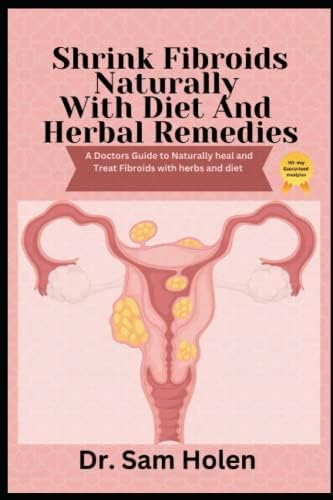 Shrink Fibroids Naturally With Diet & Herbal Remedies: A Doctors Guide to naturally heal Treat herbs diet. Proven Methods To Eliminate, Prevent leiomyoma Miracle cure myoma treatment remedy cookbook