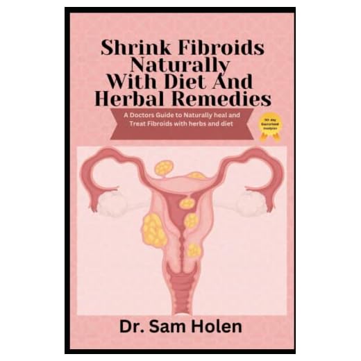Shrink Fibroids Naturally With Diet & Herbal Remedies: A Doctors Guide to naturally heal Treat herbs diet. Proven Methods To Eliminate, Prevent leiomyoma Miracle cure myoma treatment remedy cookbook