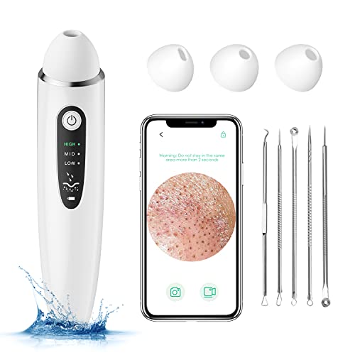 Blackhead Remover Pore Vacuum, 1080P WiFi Visible Facial Pore Ceaner, Skin Care Tool for Acne Pimples with 20X Magnification, Blackhead Extractor, Used for Extraction of Acne and Blackhead