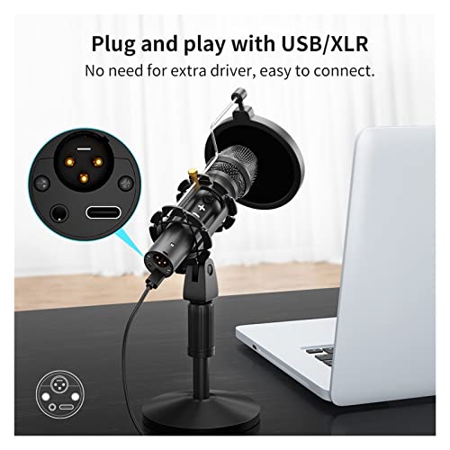 Microphone professionnel pour podcast à condensateur USB et XLR