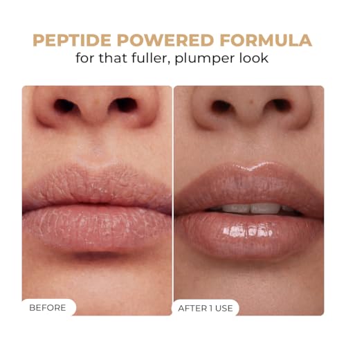 Image of Conscious Chemist Peptide Lip Balm SPF15 - Vanilla Creme | 24 hr Hydration & Moisturizing Lip Balm for Dark & Pigmented Lips | Sun Protection | Soothes Dry Lips & Repair Moisture Barrier - 15g
