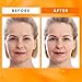 Super Vitamin C Serum for Women Over 70: Advanced Anti-Aging Formula with Vitamin C, Niacinamide, Hyaluronic Acid, Vitamin E, and Caffeine - Hydrating, Lifting, Wrinkle Reduction