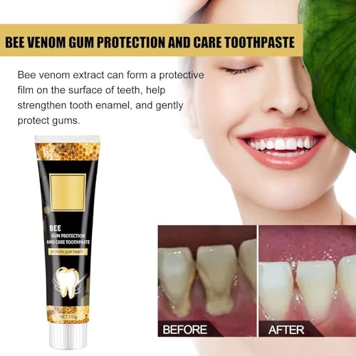 Bienengift Zahnpasta,Bienengift Zahnfleischpflege Zahnpasta Tiefenreinigung Zahnstein Flecken Zahnstein Geruch Frischer Atem Whitening Zahnpasta (2)