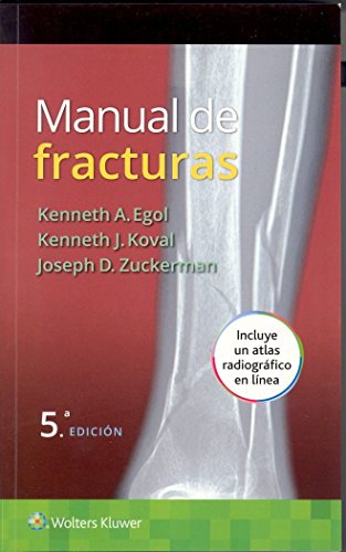 Manual de fracturas (Spanish Edition) Manual de fracturas (Spanish Edition)
