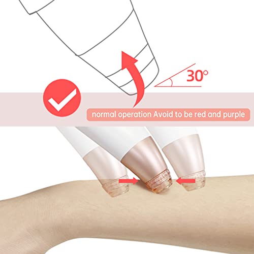 Blackhead Remover Vacuum-Blackhead Remover Tool For Men And Women Pore Cleaner, Usb Interface Type Pore Vacuum,3 Adjustment Modes & 6 Suction Heads #TOP4