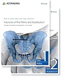 Fractures of the Pelvis and Acetabulum (AO): Principles and Methods of Management