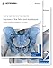 Fractures of the Pelvis and Acetabulum: Principles and Methods of Management
