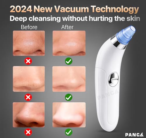Image of PANCA Blackhead Remover Vacuum for Face | 4 in 1 Pore Cleaner Suction Device with Multiple Heads | Facial Cleansing Tool for Blackhead Whitehead Removal for Men & Women