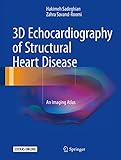 3D Echocardiography of Structural Heart Disease: An Imaging Atlas