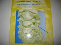 Radiofrequency Lesions of the Dorsal Root Ganglion in the Treatment of Spinal Pain 9090096817 Book Cover