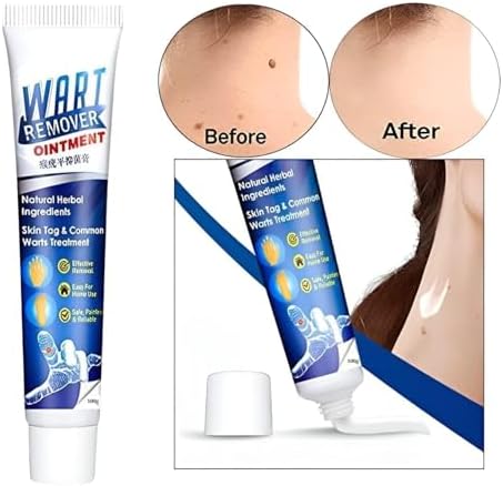Ladila Wart Remover Ointment Natural Extract Gentle Safe, massa remover ointment for skin | skin tag remover cream, tag remover for men or women
