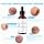 Salicylicum Acidum 30% – 3 fl oz / 90ml - 2