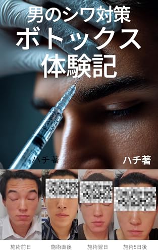 Botox treatment for mens wrinkles starting from age twenty eight: Prevents wrinkles and strengthens wrinkles (Japanese Edition)