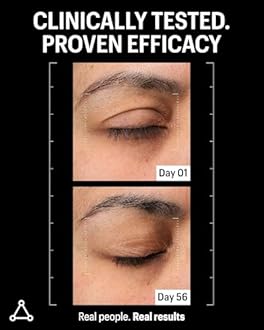 Allies of Skin Multi Peptides & Growth Factor Collagen Boosting Face Serum | Skin Tightening Anti-Aging Complex with 9% Peptides| Firms Sagging Skin & Visibly Reduces Wrinkles (1 oz)