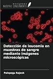 tecnicas de preparacion de muestras microscopicas  Detección de leucemia en muestras de sangre mediante imágenes microscópicas