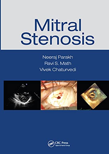 Mitral Stenosis 1st Edition