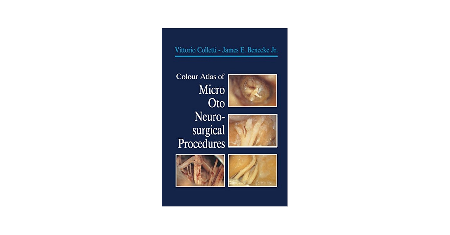 Amazon.com: Colour Atlas of Micro-Oto-Neurosurgical