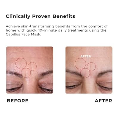 Capillus Red Light Face Mask - 4 Light Modes Wireless LED Face Mask Light Therapy for Wrinkles, Fine Lines, Dark Spots, Acne - Near-Infrared, Blue & Red Light Therapy for Face - FDA Cleared