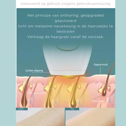 IPL Ontharingsapparaat - Haarverwijderaar voor Mannen en Vrouwen – Lichtontharing – Pijnloos Haar Verwijderen – 500.000 Flitsen - Roze - Afbeelding 6