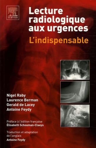 Amazon.fr - Lecture radiologique aux urgences: L'indispensable - Raby ...