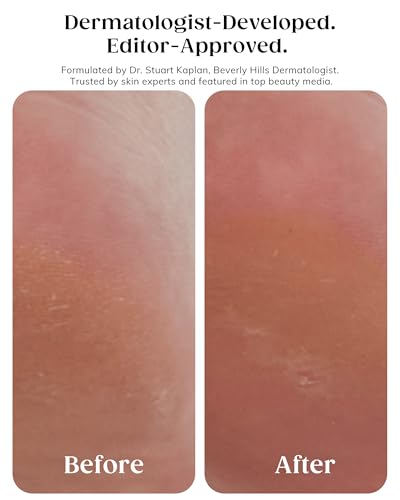 KAPLAN MD Diamond Contour Insta-Glow Gommage Body Peel – Body Exfoliator & Skin Peel with Glycolic Acid, Pineapple Ceramides & Crushed Diamonds - Exfoliating for Smooth, Radiant Skin, 10.14 fl oz