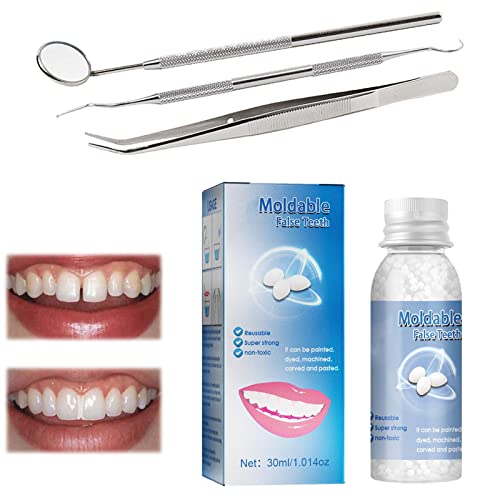 UBSS Tooth Repair Granules - Teeth Repair Kit, Moldable False Teeth Thermal Fitting Beads, for Temporary Fixing The Missing and Broken Tooth Replacements (A-1PCS) Cover