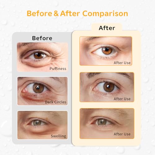 Image of 4PCS Gel Eye Ice Pack Set, Cold & Hot Compress, Reusable Cooling Gel Pads for Strain Relief, Relaxation, SPA and Sleep (4 Oranges-2)