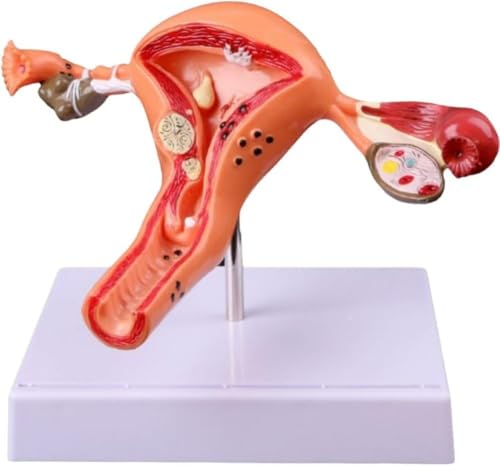 Modèle d'anatomie des organes génitaux féminins pour expliquer facilement les pathologies