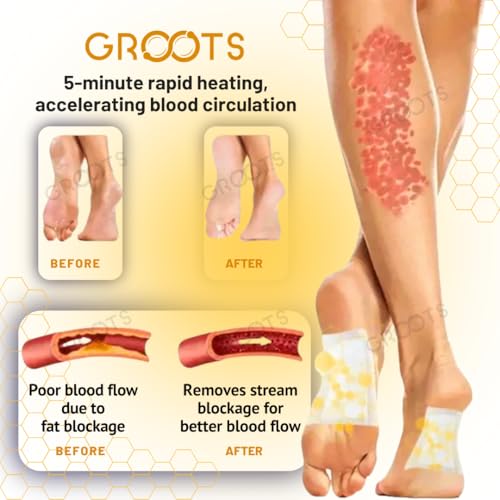 Image of GROOTS Foot patch Detox Foot patches Pain Relief Detox patch Cleansing Toxin Remover Foot Pads Detoxify Stress Relief Sleep Patch for Detoxification For Men And Women (1 BOXES = 20 Patches) ((20 count) pack of 2)