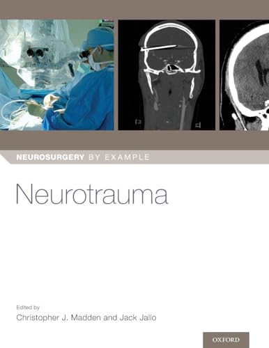 Neurotrauma (Neurosurgery by Example) view 2