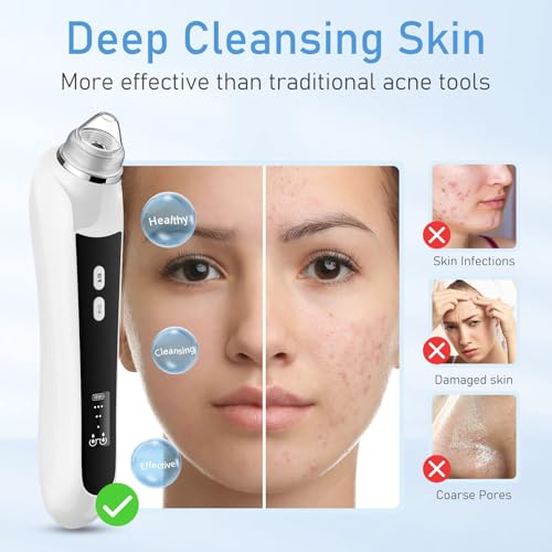 Image of HD Camera USB Blackhead Remover, 3 Modes 6 Heads for Men Women | 20x magnified cleaning, APP WiFi connection, adjustable vacuum suction, effective blackhead removal, one-month long standby
