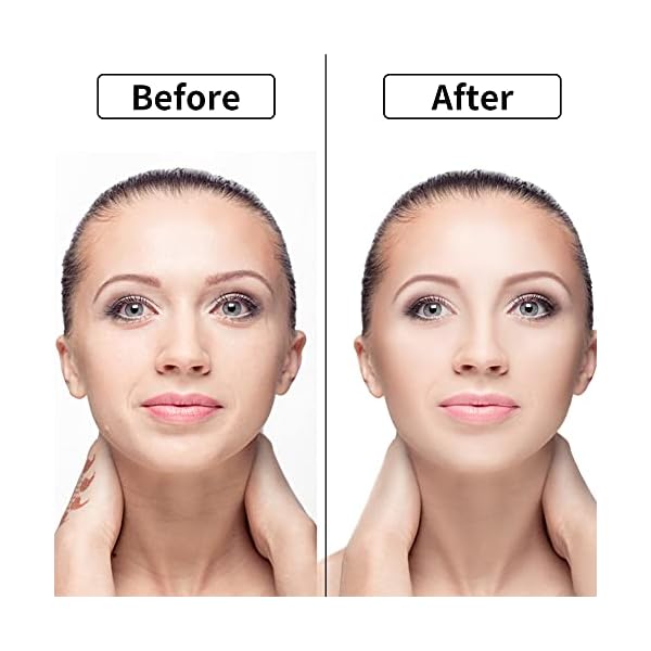 Anti-Wrinkle-Patches-6pcs-Reusable-Silicone-Anti-Wrinkle-Tightening-Patch-for-Face-Facial-Anti-Wrinkle-Face-Tape-Smoothing-Wrinkle-Strips-For-Forehead-Eyes-Chin Anti Wrinkle Patches, 6pcs Reusable Silicone Anti Wrinkle Tightening Patch for Face, Facial Anti Wrinkle Face Tape Smoothing Wrinkle Strips For Forehead Eyes Chin