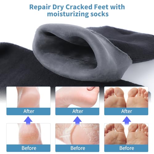 ALUROICE 11" Large Silicone Moisturizing Socks for Men - 2 Pairs Soft Foot Care Socks - Feet Moisturizing Socks for Dry Cracked Feet (Size L)