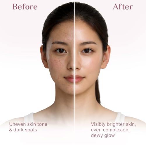 Image of Seoulskin Kojic Acid Sunscreen SPF 50 PA ++++ | Helps Fade Dark Spots & Pigmentation | Non - Sticky & Non- Greasy | No White Cast | Broad Spectrum UVA & UVB Protection | All Skin Types | For Men & Women | Lightweight Korean Sunscreen | 50 g